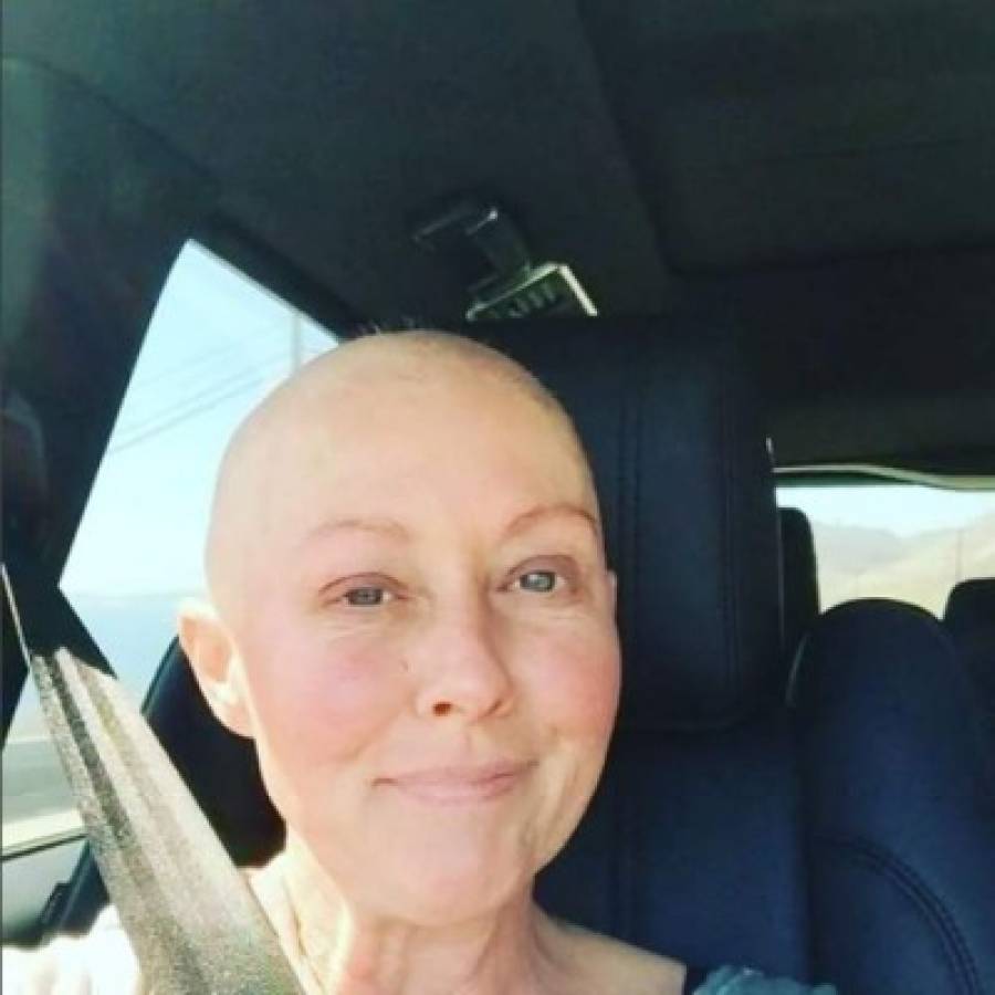 Shannen Doherty publica íntimas fotos sobre su lucha contra el cáncer