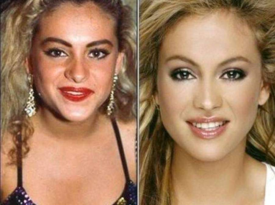 Antes y después: así lucen varias famosas mexicanas después de las cirugías