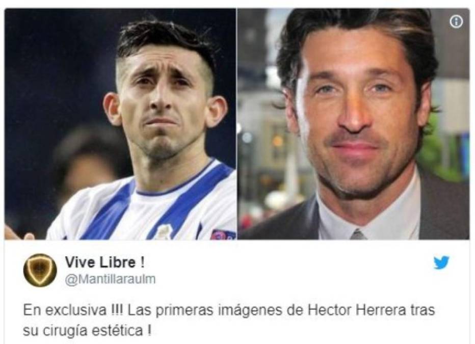 Despiadada ola de memes contra Héctor Herrera tras su cirugía en nariz y orejas