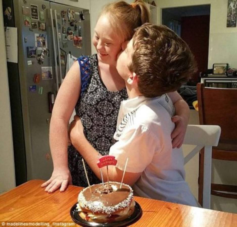 Modelo con Síndrome de Down publicó foto con su novio y es viral
