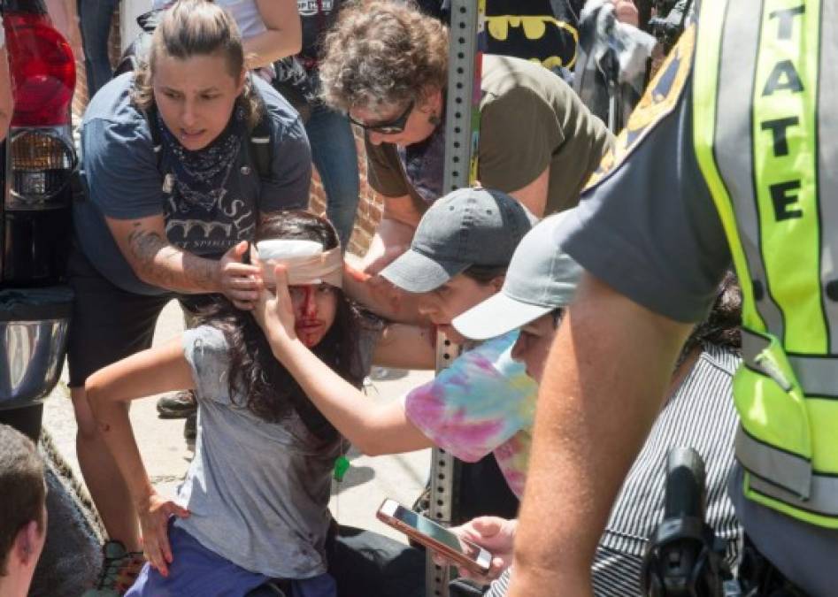 Las fotos más impactantes que dejó el ataque racista en Charlottesville, Virginia, Estados Unidos