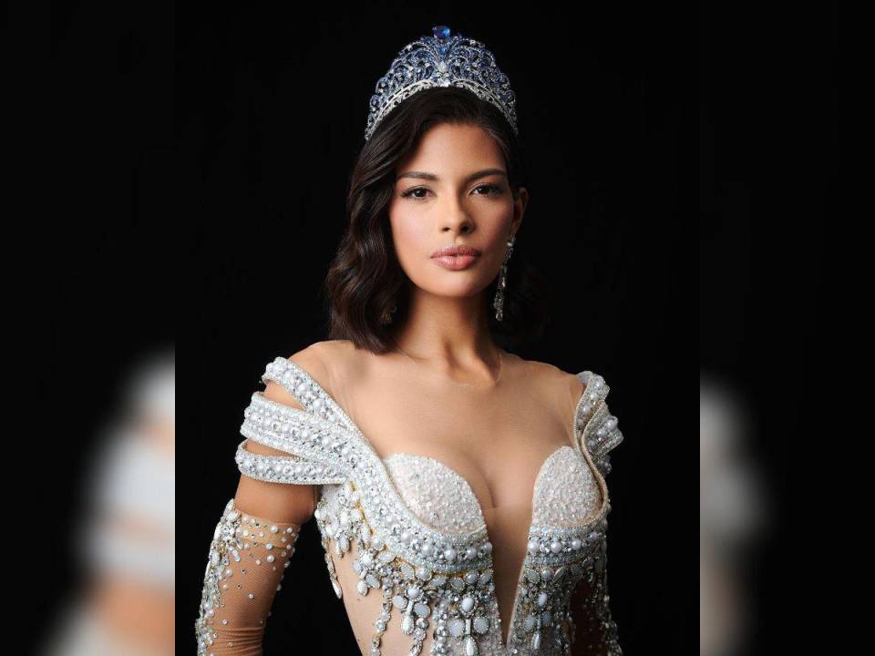 La hermosa nicaragüense, Sheynnis Palacios, se convirtió en la nueva Miss Universo el pasado 18 de noviembre y desde su coronación mucho se ha especulado sobre sus retoques físicos, por lo que a continuación te contamos qué procedimientos estéticos se ha realizado.