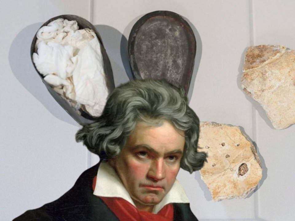 Los fragmentos de cráneo, supuestamente de Ludwig van Beethoven.