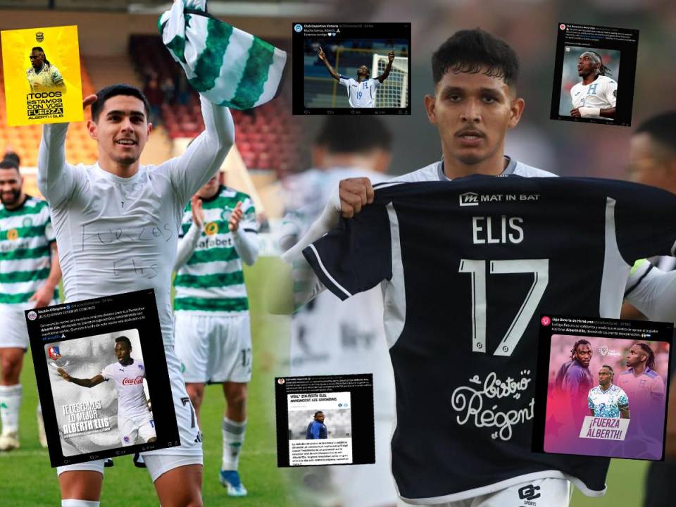 No hay nuevas noticias sobre Alberth Elis, pero los jugadores, equipos y toda Honduras sigue pendiente de él, deseándole fuerza en el partido por su vida.