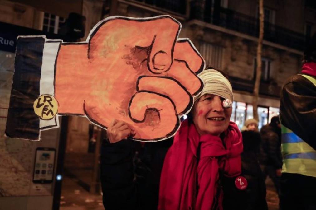 FOTOS: Disturbios y miles de personas en las calles de Francia contra reforma de pensiones
