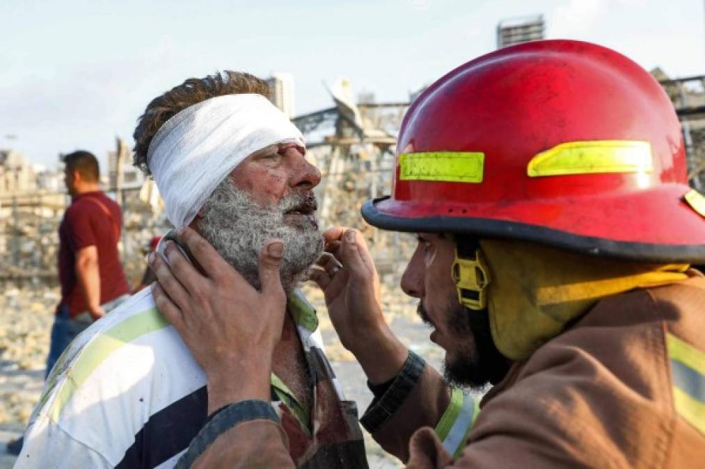 Dolorosas e impactantes imágenes de la devastadora explosión en Beirut