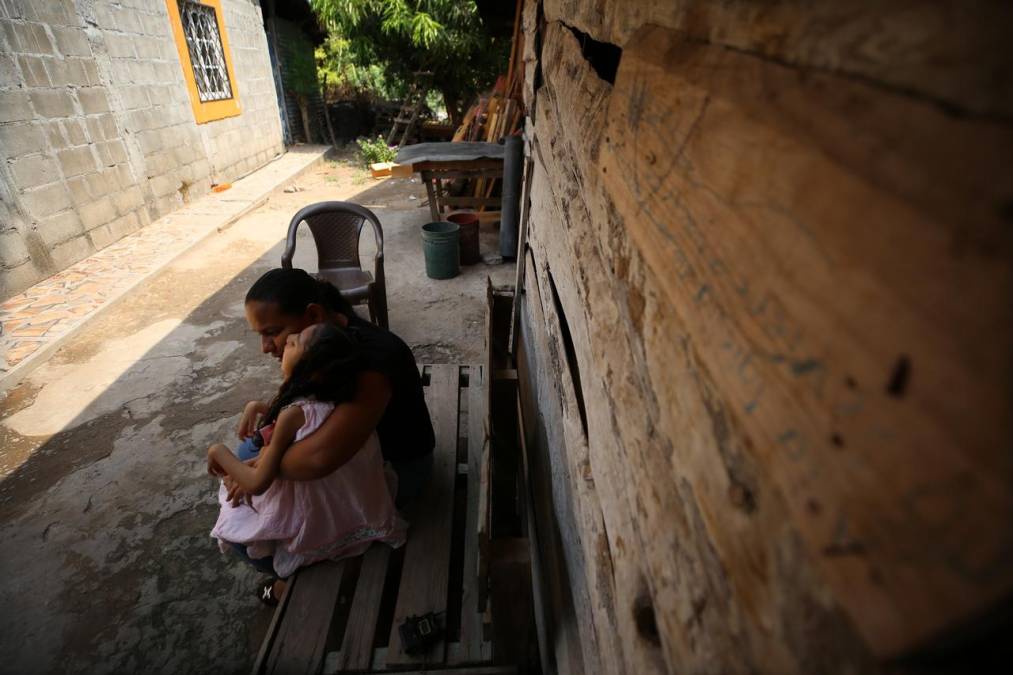 Los hijos del zika sobreviven en medio de la calamidad: las historias no contadas