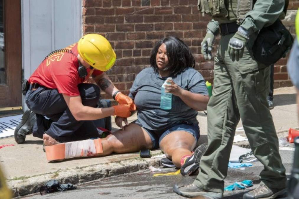 Las fotos más impactantes que dejó el ataque racista en Charlottesville, Virginia, Estados Unidos