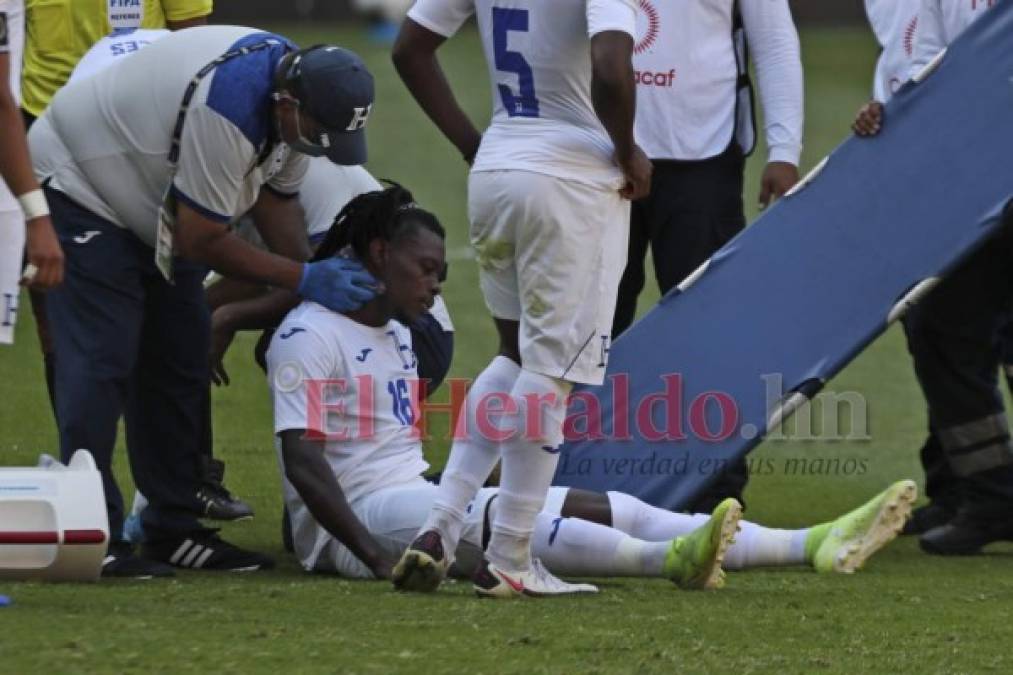 FOTOS: Las mejores jugadas del duelo de la Sub-23 de Honduras rumbo a Tokio 2021