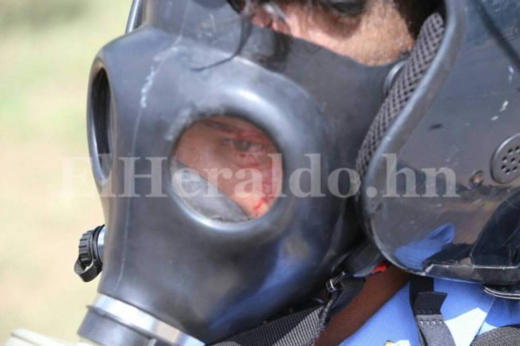 Impactantes fotos: Batalla campal fuera de la UNAH deja varios policías con quemaduras