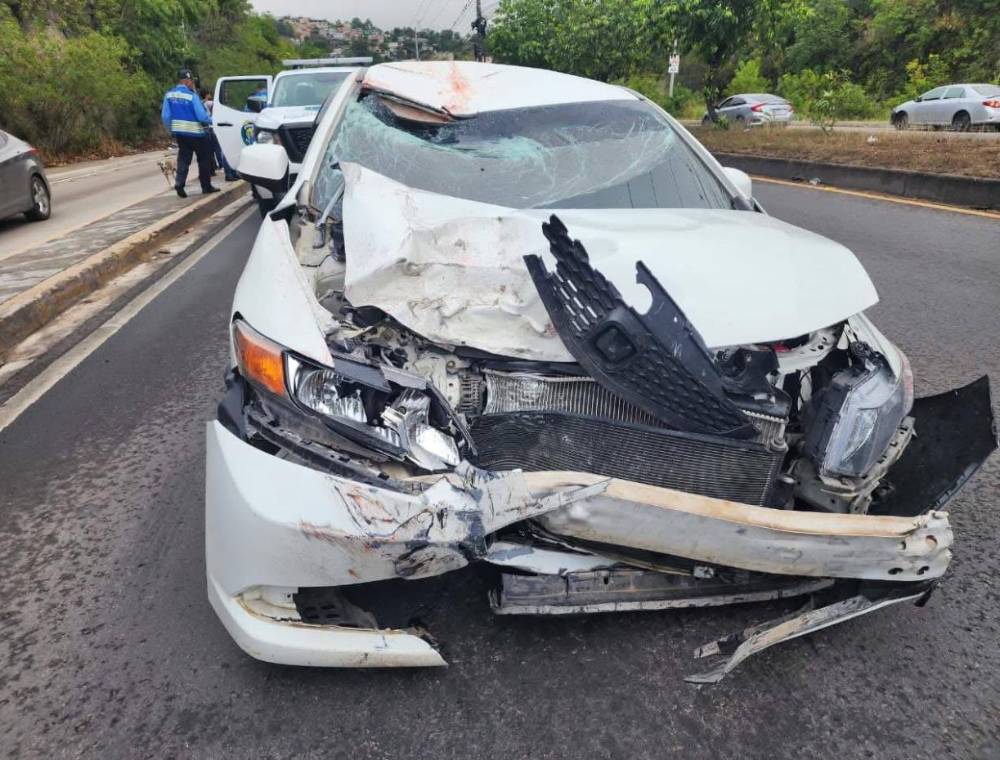 José Mendoza, acusado de atropellar a motociclista, se defenderá en libertad ¿La razón?