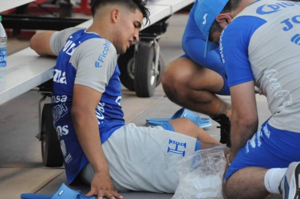 Lesiones y enfermedades que afectan a Honduras en la Copa Oro 2021
