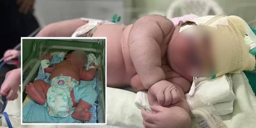 Pesó 16 libras y midió 59 centímetros: así es Angerson, el bebé brasileño más pesado del mundo