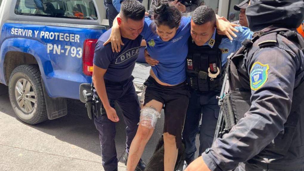 Las 25 imágenes más impactantes de la matanza que dejó al menos 41 víctimas en PNFAS