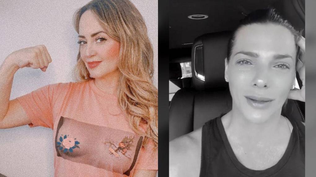 ¿Qué es la enfermedad de implantes mamarios y qué famosas lucharon contra ella?