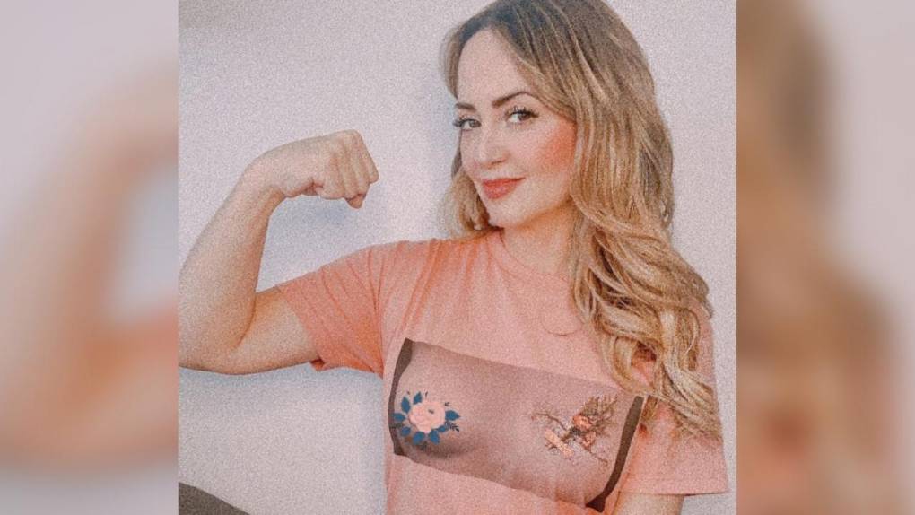 ¿Qué es la enfermedad de implantes mamarios y qué famosas lucharon contra ella?