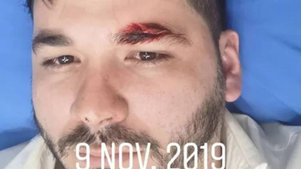 Líos con presentadoras, una demanda millonaria y conflictos deportivos: las polémicas detrás de Romell Quioto