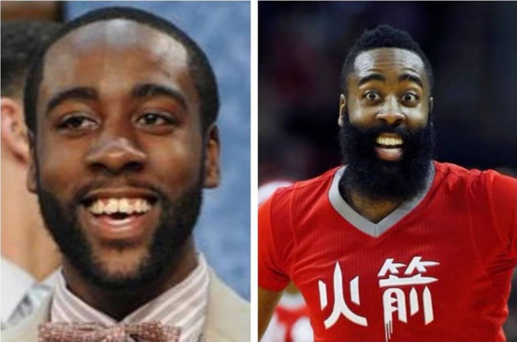 El antes y después de los deportistas internacionales que arreglaron sus dientes