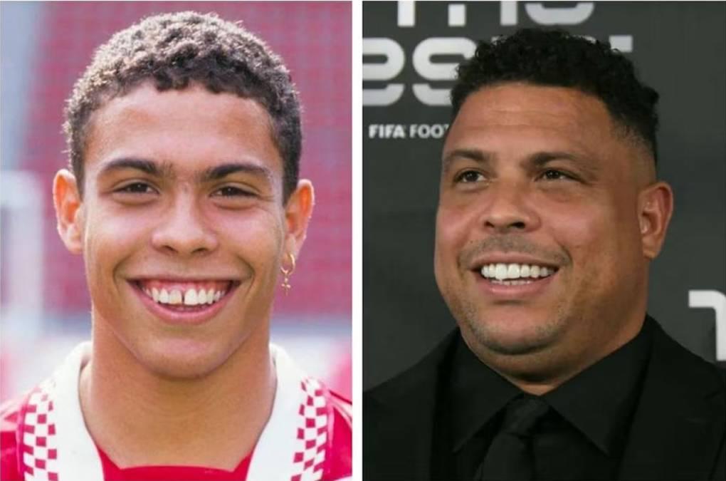 El antes y después de los deportistas internacionales que arreglaron sus dientes