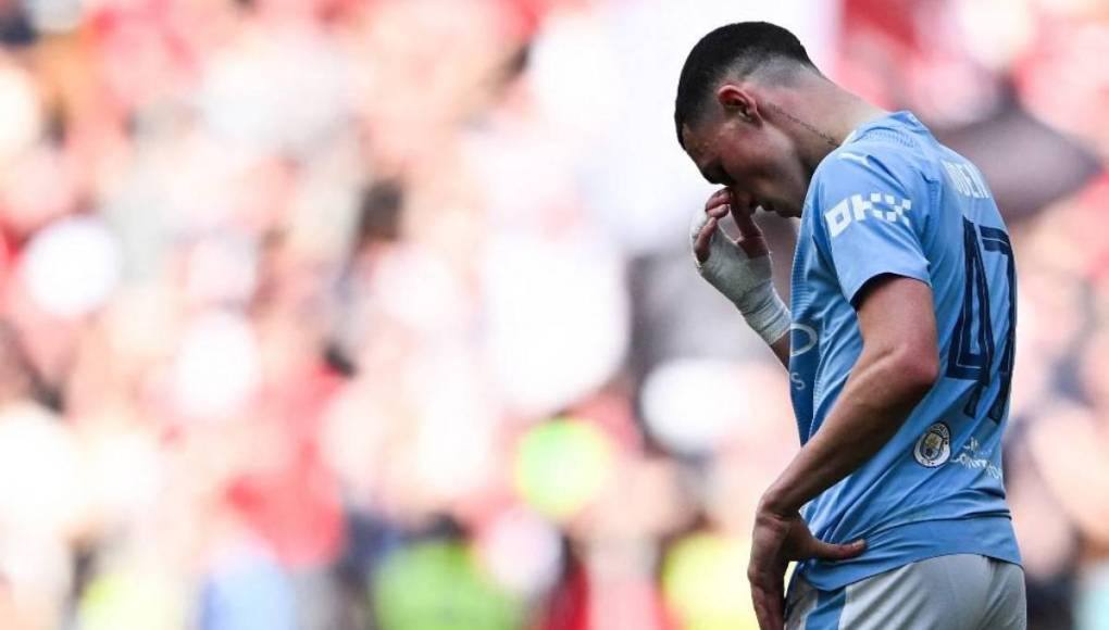 La tristeza de Pep Guardiola y su Manchester City al perder FA Cup ante el United