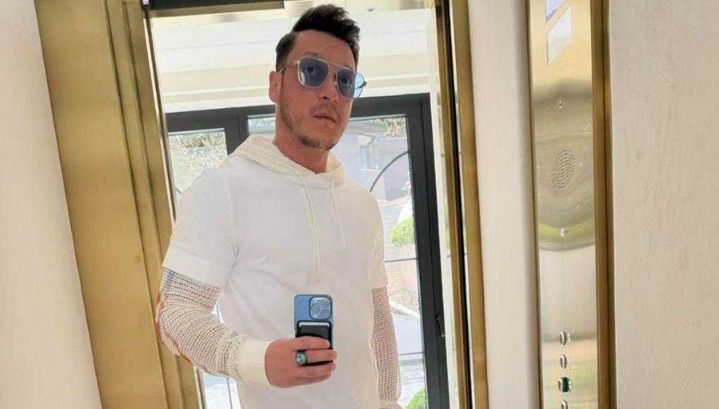 Ex Real Madrid y campeón del mundo: impresionante cambio físico de Özil