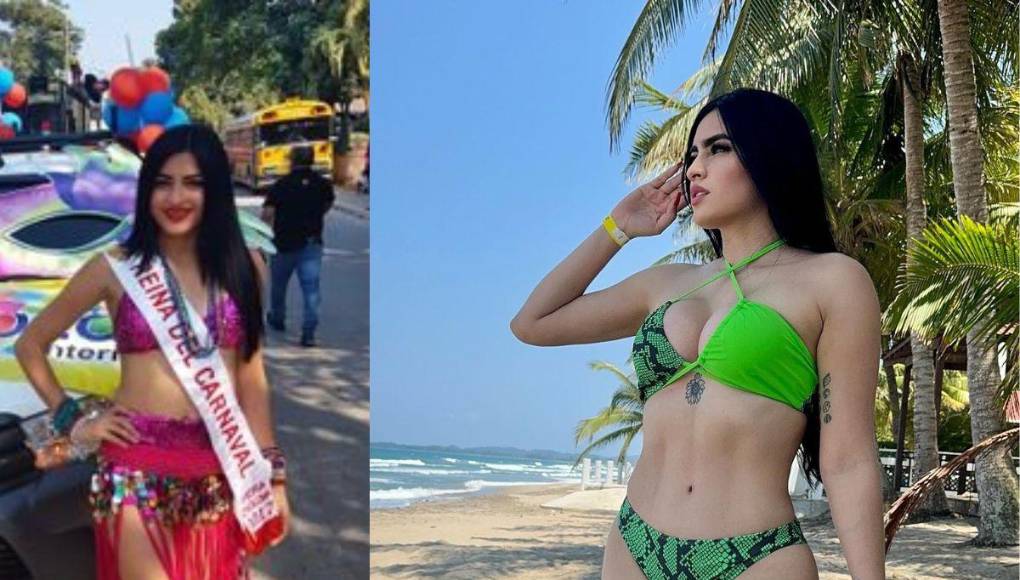 Roxana Somoza: Así ha sido su radical cambio físico tras varios retoques estéticos