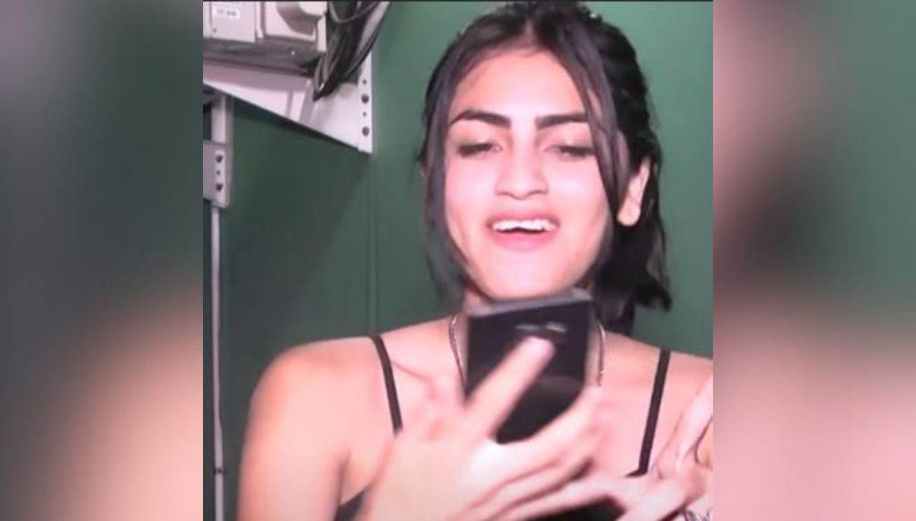 Roxana Somoza: Así ha sido su radical cambio físico tras varios retoques estéticos