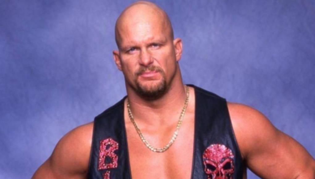 ¿Irreconocibles? Así se veían estos calvos famosos cuando tenían cabello