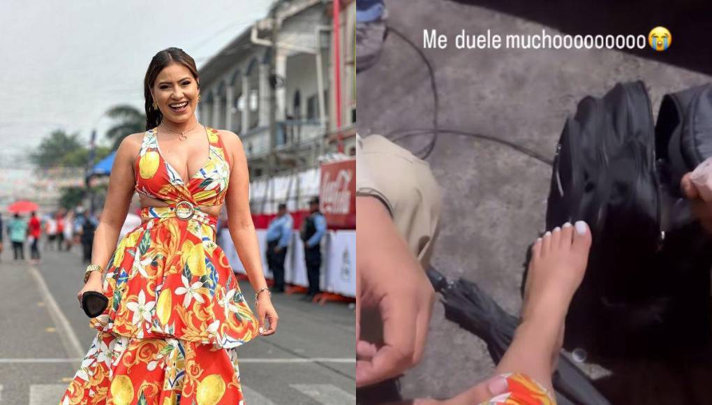 Alejandra Rubio se lesiona el pie en Carnaval de La Ceiba al esquivar un caballo