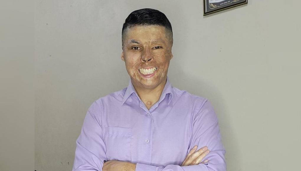 Así lucía el bombero Ever Velásquez antes de quemarse en incendio de ‘La Montañita’