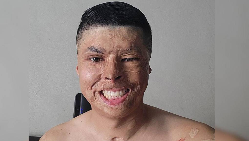 Así lucía el bombero Ever Velásquez antes de quemarse en incendio de ‘La Montañita’