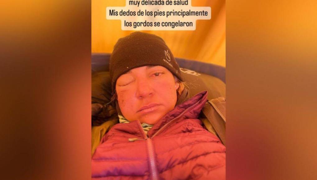 Dora Raudales se encuentra en recuperación luego de escalar el Monte Everest
