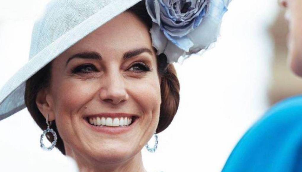 Kate Middleton se ausentaría más tiempo por una cirugía: ¿De qué se trata?