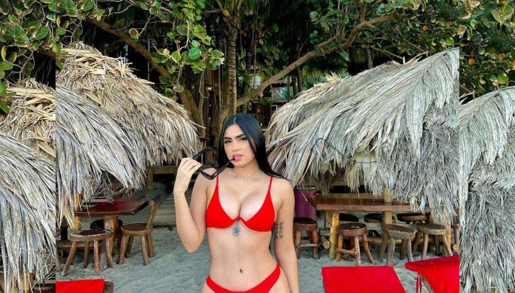 Roxana Somoza: Así ha sido su radical cambio físico tras varios retoques estéticos