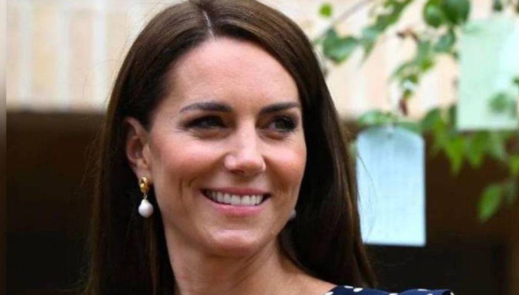 Kate Middleton se ausentaría más tiempo por una cirugía: ¿De qué se trata?