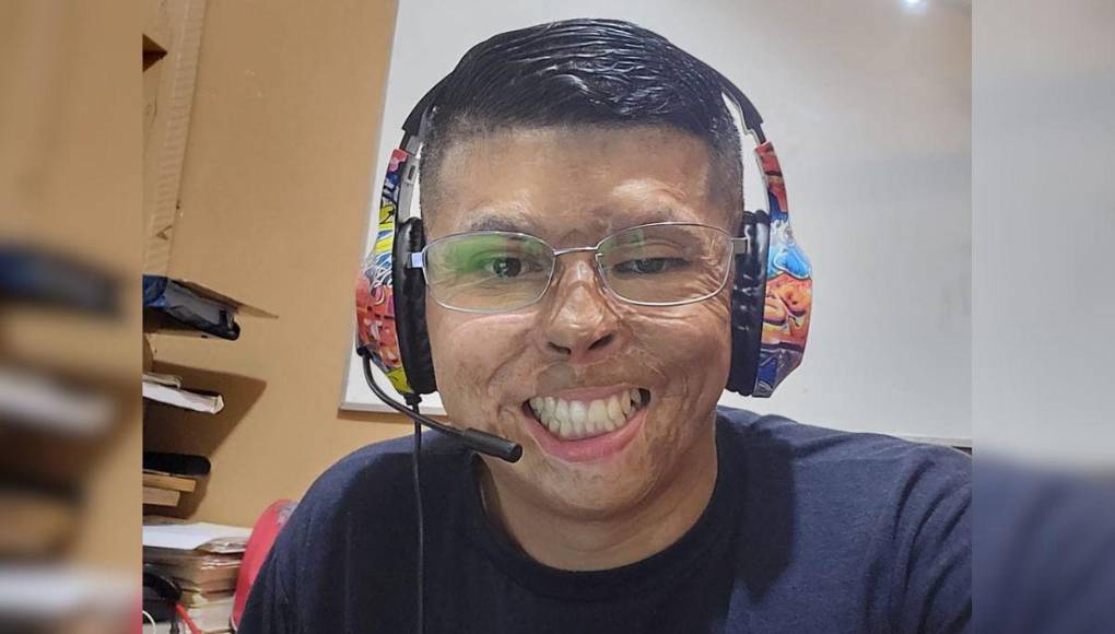 Así lucía el bombero Ever Velásquez antes de quemarse en incendio de ‘La Montañita’