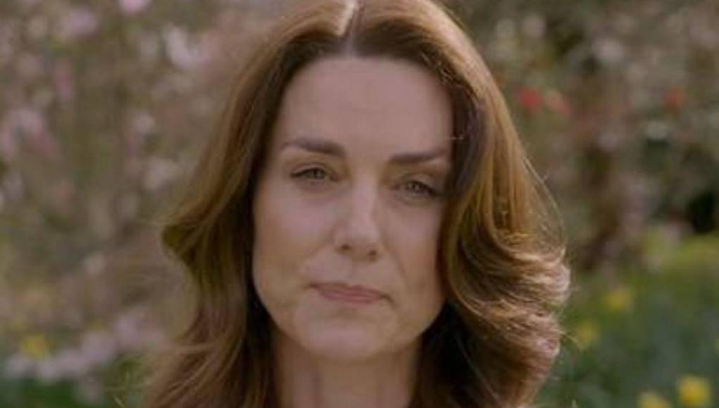 Kate Middleton se ausentaría más tiempo por una cirugía: ¿De qué se trata?