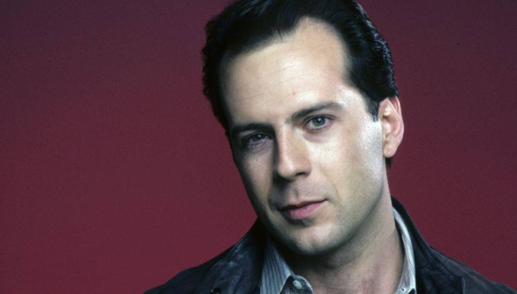 ¿Irreconocibles? Así se veían estos calvos famosos cuando tenían cabello