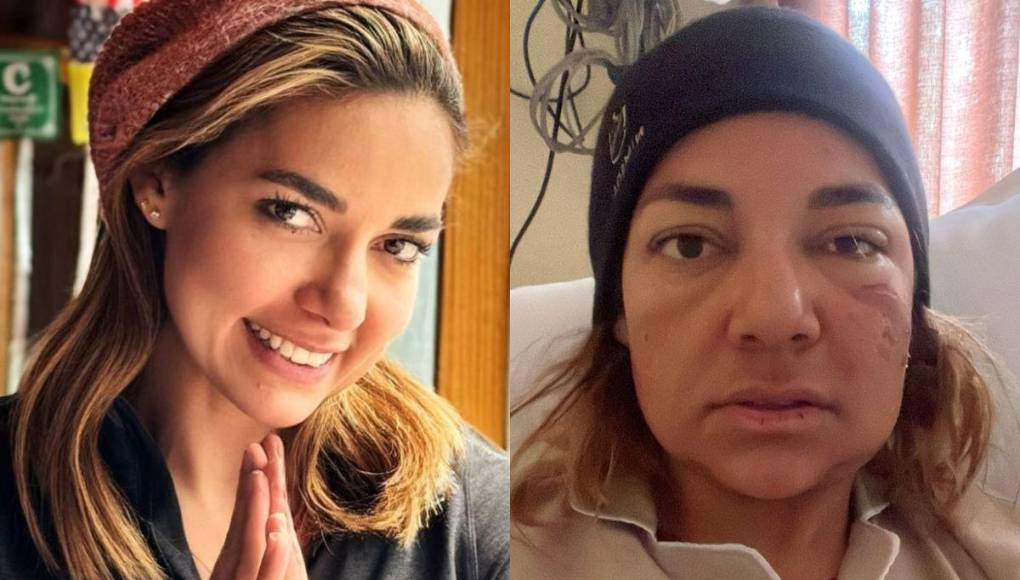 Dora Raudales se encuentra en recuperación luego de escalar el Monte Everest