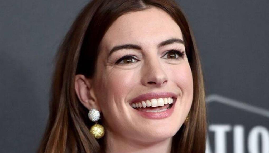 Anne Hathaway besó a diez hombres en un mismo día: “Fue asqueroso”