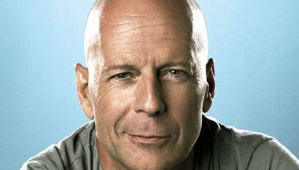 ¿Irreconocibles? Así se veían estos calvos famosos cuando tenían cabello