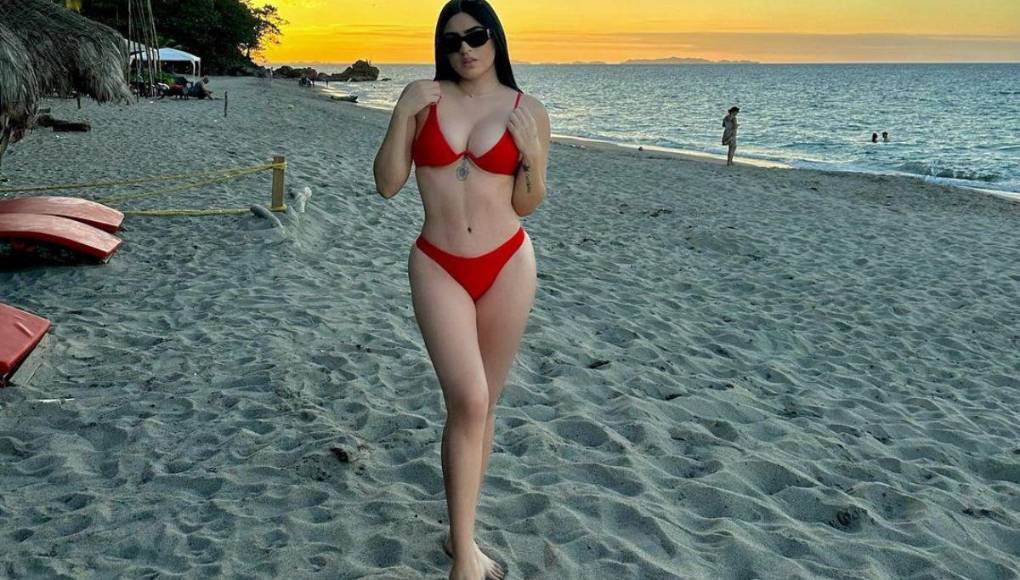 Roxana Somoza: Así ha sido su radical cambio físico tras varios retoques estéticos