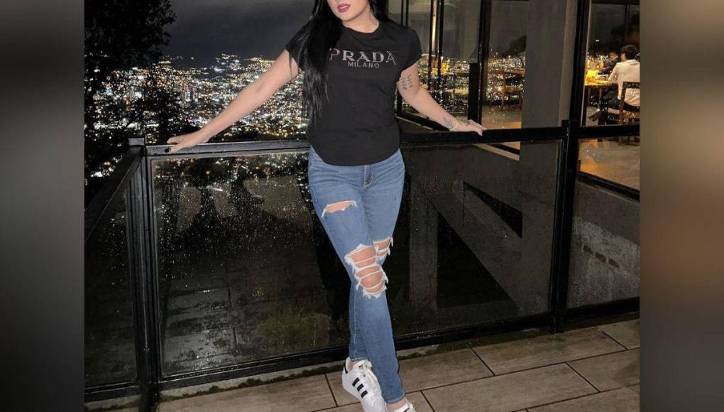 Roxana Somoza: Así ha sido su radical cambio físico tras varios retoques estéticos