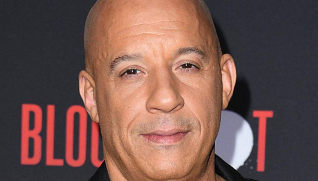 ¿Irreconocibles? Así se veían estos calvos famosos cuando tenían cabello