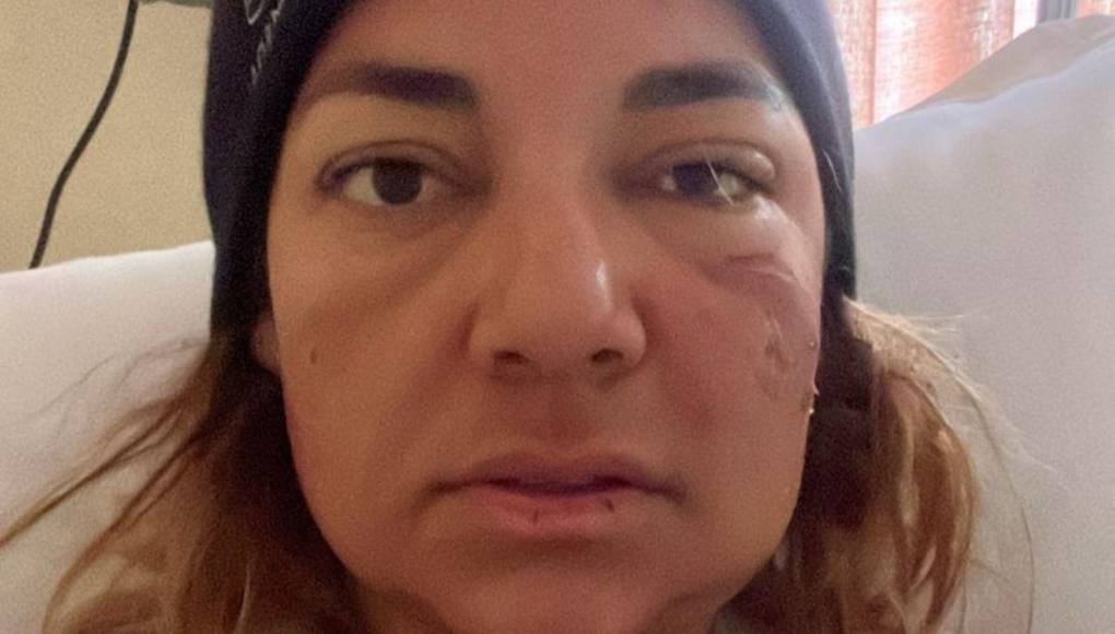 Dora Raudales se encuentra en recuperación luego de escalar el Monte Everest