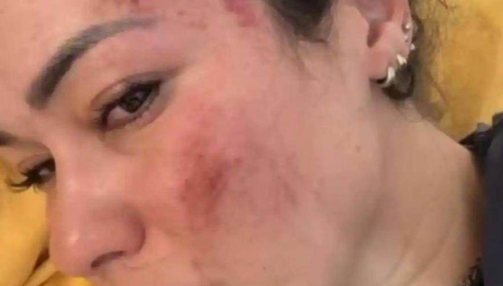 Fernanda, influencer española que fue violada por siete hombres en India