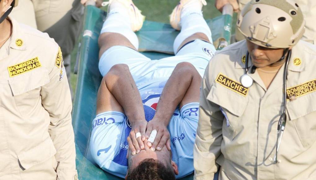 Lo que no se vio en TV: Reclamos fuertes, lágrimas en Motagua y bellas modelos