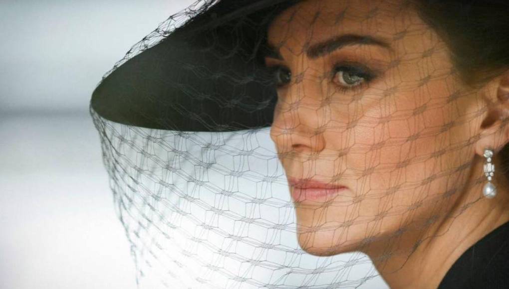 Kate Middleton se ausentaría más tiempo por una cirugía: ¿De qué se trata?