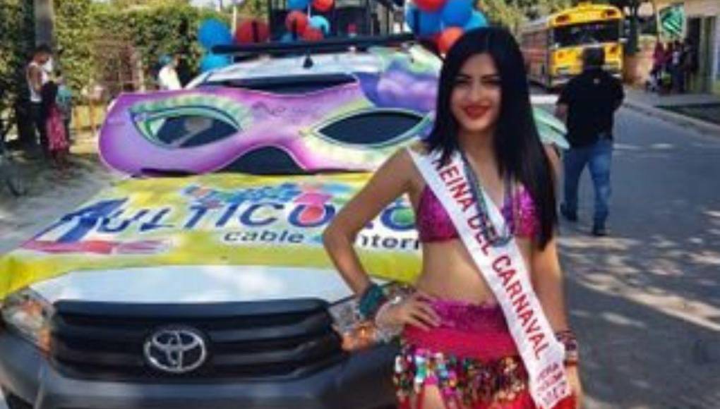 Roxana Somoza: Así ha sido su radical cambio físico tras varios retoques estéticos