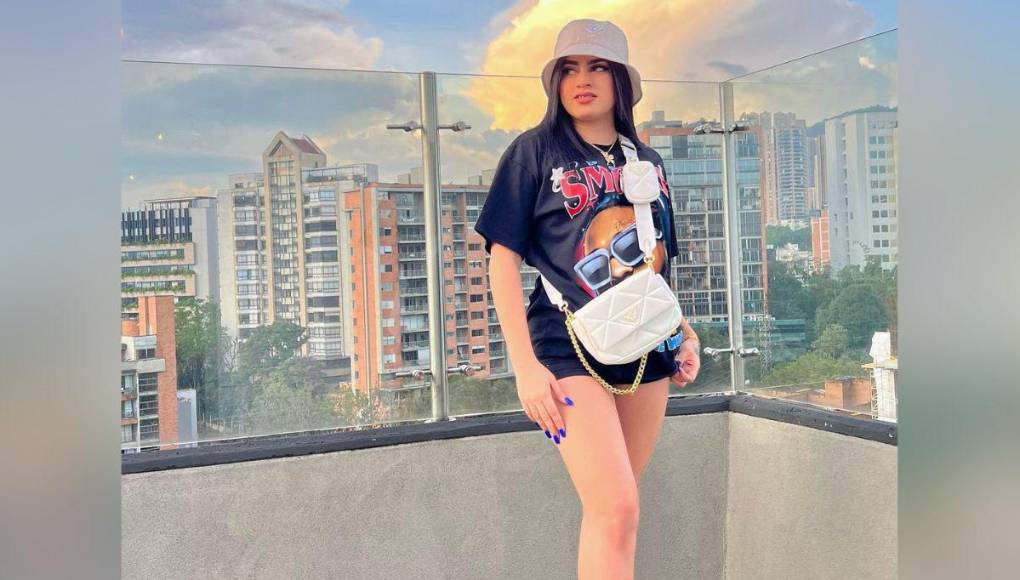 Roxana Somoza: Así ha sido su radical cambio físico tras varios retoques estéticos